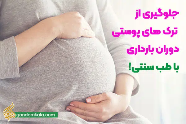 جلوگیری از ترک های پوستی در بارداری